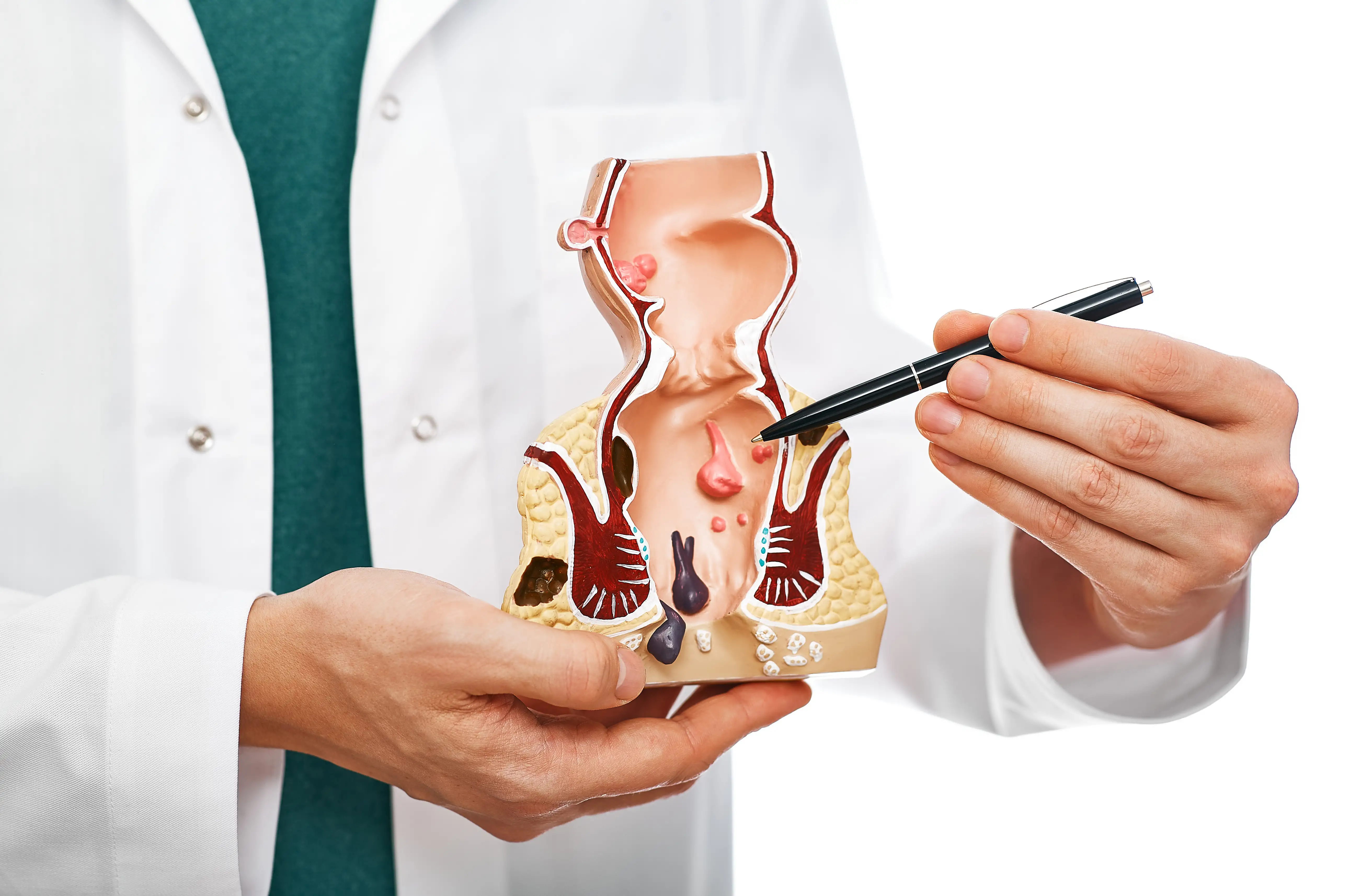 Fissure Treatment in Patel Para Raipur - Shri Ganpati Piles Clinic